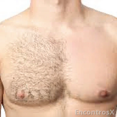 Depilador masculino : cera , máquina de aparar e a laser