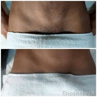 Depilação íntima