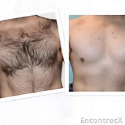 Depilação masculina - Profissional masculino
