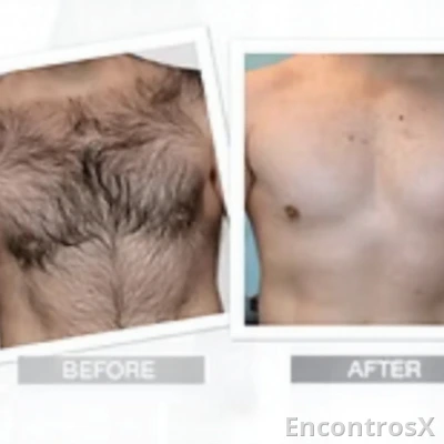 Depilação masculino