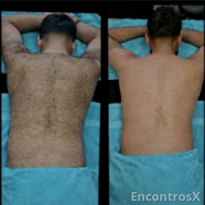 Depilação masculino