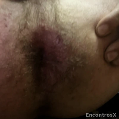 Bi pass desloca